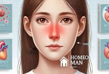 Homeopathic Medicine for Allergic Rhinitis